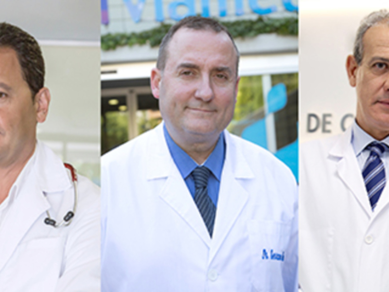 La fibrilación auricular cuadruplica el riesgo de ictus y duplica el riesgo de muerte